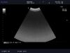 ALOKA ASU-1010 Ultrasound Transducer