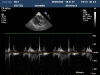 PHILIPS S8-3 Ultrasound Transducer