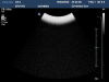 PHILIPS C9-4 Ultrasound Transducer