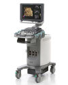 SIEMENS Acuson X300 Ultrasound - Shared Service