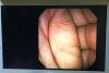 OLYMPUS GF-UC160P AT8 Gastroscope