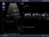 ALOKA UST-990-5 Ultrasound Transducer