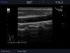 ALOKA UST-5524 Ultrasound Transducer
