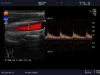 ALOKA UST-5524 Ultrasound Transducer