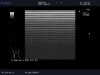 ALOKA UST-5534T-7.5 Ultrasound Transducer