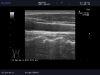 ALOKA UST-5534T-7.5 Ultrasound Transducer
