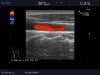 ALOKA UST-5534T-7.5 Ultrasound Transducer