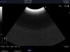 ALOKA UST-9147 Ultrasound Transducer