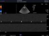 ALOKA UST-52129 Ultrasound Transducer