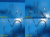 JARIT V. Mueller COMPLETE PROFESSIONAL THYROPLASTY (Larynx) Surgery Set