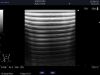ALOKA ASU-1013 Ultrasound Transducer