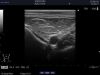 ALOKA ASU-1013 Ultrasound Transducer