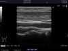 ALOKA ASU-1013 Ultrasound Transducer