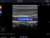 ALOKA ASU-1013 Ultrasound Transducer