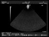 HITACHI EUP-S50 Ultrasound Transducer
