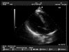 HITACHI EUP-S50 Ultrasound Transducer