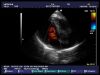 HITACHI EUP-S50 Ultrasound Transducer