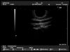 HITACHI EUP-V33W Ultrasound Transducer