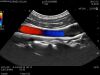 HITACHI C42 Ultrasound Transducer