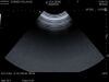 HITACHI VC34 Ultrasound Transducer