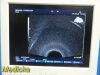 HITACHI EUP-R53W Endo-Cavity Ultrasound Transducer
