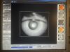 ZEISS VISUCAN NM/FA- FAF /ICG Fundus Camera