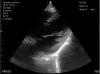 TOSHIBA PVT-382BT Ultrasound Transducer