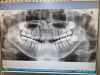 VATECH Implagraphy (Picasso Trio) 2D+3D+Ceph Dental X-Ray