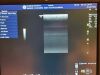GE L8-18i-D Ultrasound Transducer