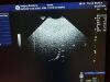 GE RNA5-9-D Ultrasound Transducer