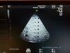 GE 3SC-RS Ultrasound Transducer