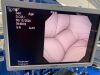 OLYMPUS CYF-V2 Cysto-Nephro Videoscope Cystoscope