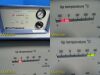 D.O.R.C 1500.02 Cryosystem Model 1602 Cryosurgical Unit With Cart