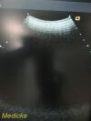 SIEMENS/ACUSON 2009 Acuson 4C1 Model 08258525 Convex Array Ultrasound Transducer Probe Ultrasound Transducer