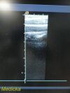 ACUSON 15L8 Ergo Linear Array Ultrasound Transducer