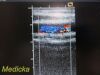 ACUSON 15L8 Ergo Linear Array Ultrasound Transducer
