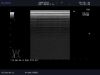 ALOKA UST-5536-7.5 Ultrasound Transducer