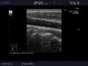 ALOKA UST-5536-7.5 Ultrasound Transducer