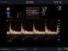 ALOKA UST-5713T Ultrasound Transducer