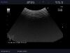 ALOKA UST-9132I Ultrasound Transducer