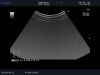 ALOKA UST-9132I Ultrasound Transducer