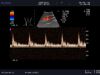 ALOKA UST-9132I Ultrasound Transducer