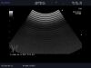 ALOKA UST-9132T Ultrasound Transducer