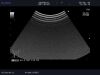 ALOKA UST-9132T Ultrasound Transducer