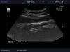 ALOKA UST-9132T Ultrasound Transducer