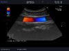 ALOKA UST-9132T Ultrasound Transducer