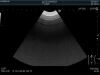 HITACHI C22P Ultrasound Transducer