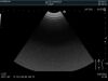 HITACHI C22P Ultrasound Transducer