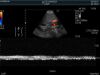 HITACHI C22P Ultrasound Transducer