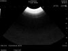 HITACHI C22T Ultrasound Transducer